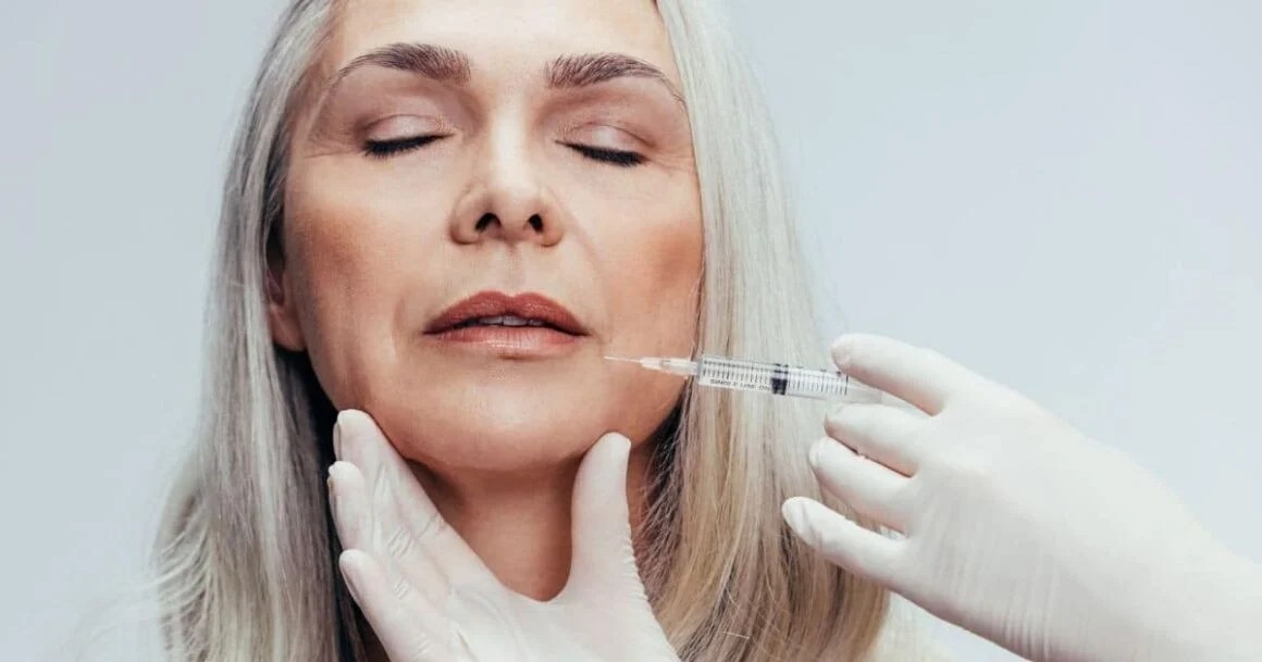 The Best Dermal Fillers For Over 40