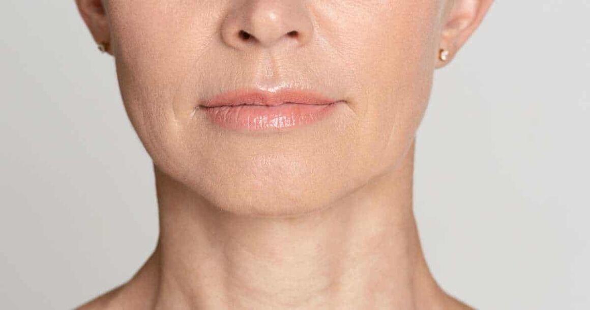 Best Treatments For Lip Lines And Wrinkles